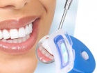 Особенности отбеливания зубов — дома и у специалиста